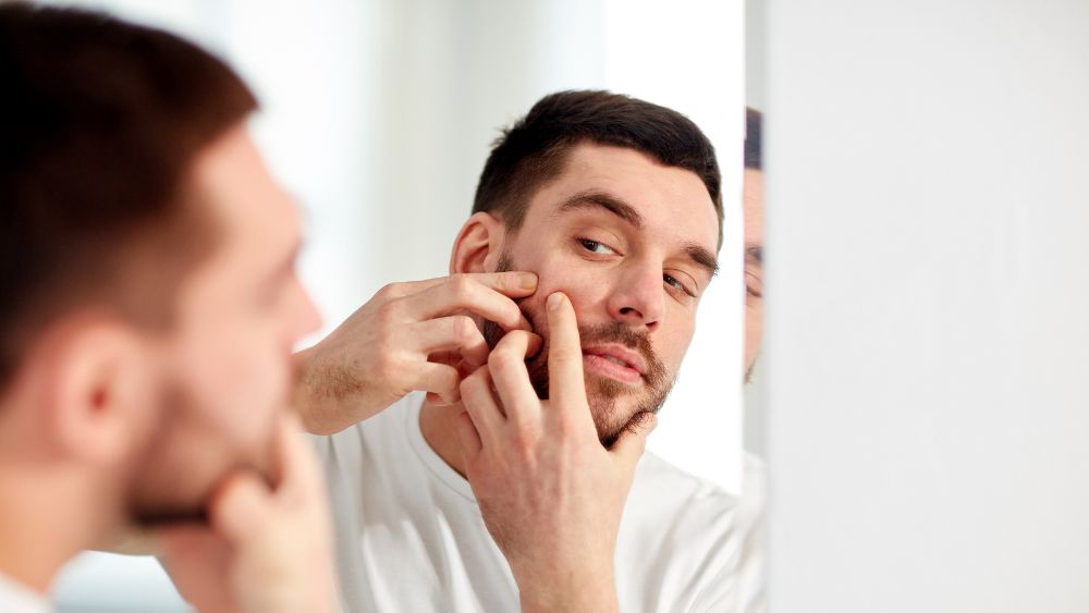 Beard Pimples Explained & Treatment