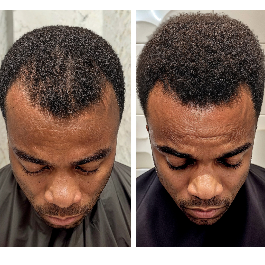12 Month Hair Rebuild System - Full Price