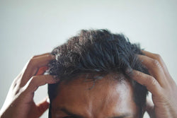 Signs of an Unhealthy Scalp and How to Fix It