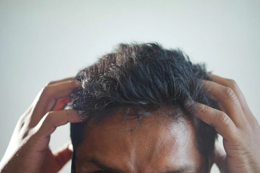 Signs of an Unhealthy Scalp and How to Fix It
