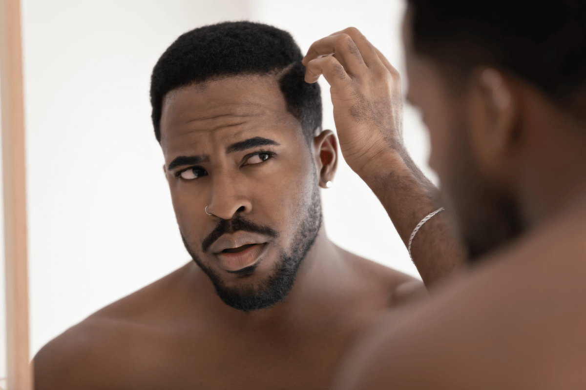 Thinning Hair & Male Pattern Hair Loss