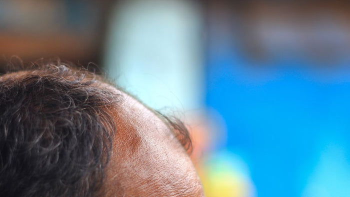 Best Oil for Receding Hairline: Growth Tips