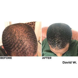 MY Hair Activation Elite System