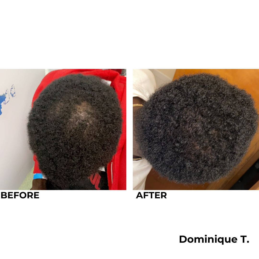 MY Hair Activation Elite System