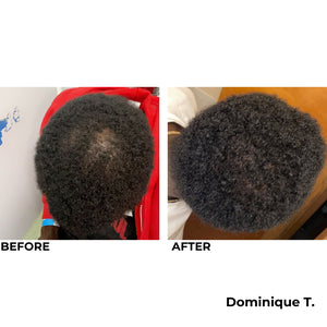 MY Hair Activation Elite System