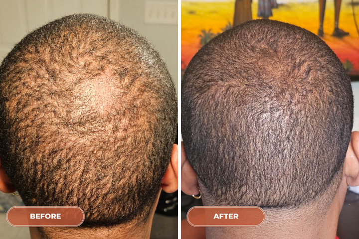 12 Month Hair Rebuild System - Monthly