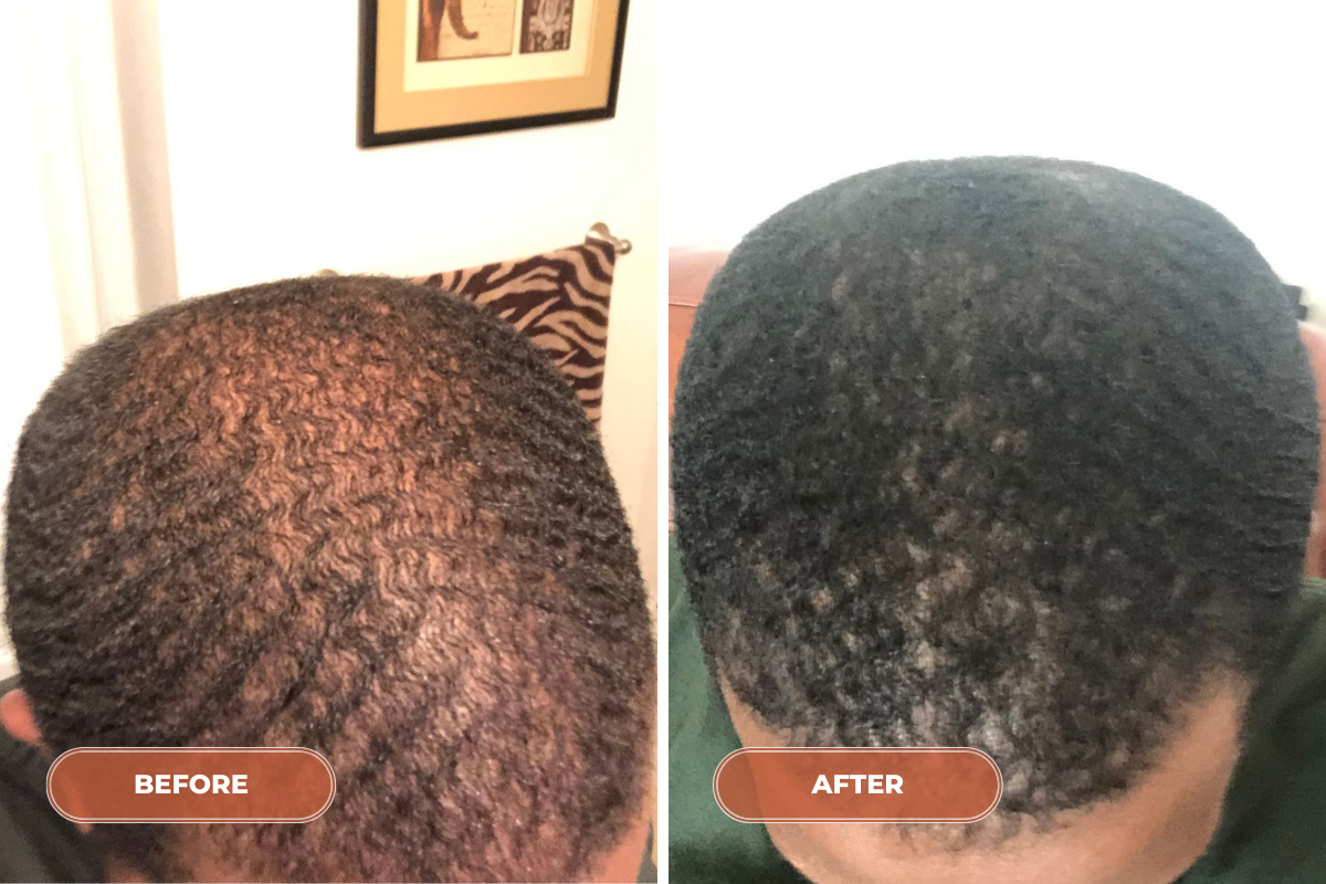 12 Month Hair Rebuild System - Monthly