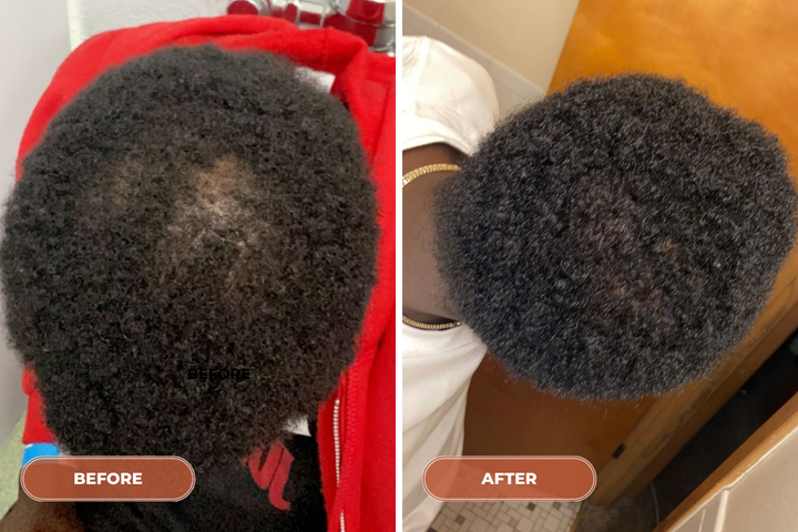 12 Month Hair Rebuild System - Monthly
