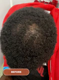 Before image 2