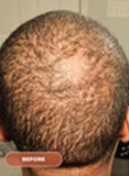 Before image 3