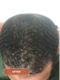 After image 1
