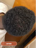 After image 2